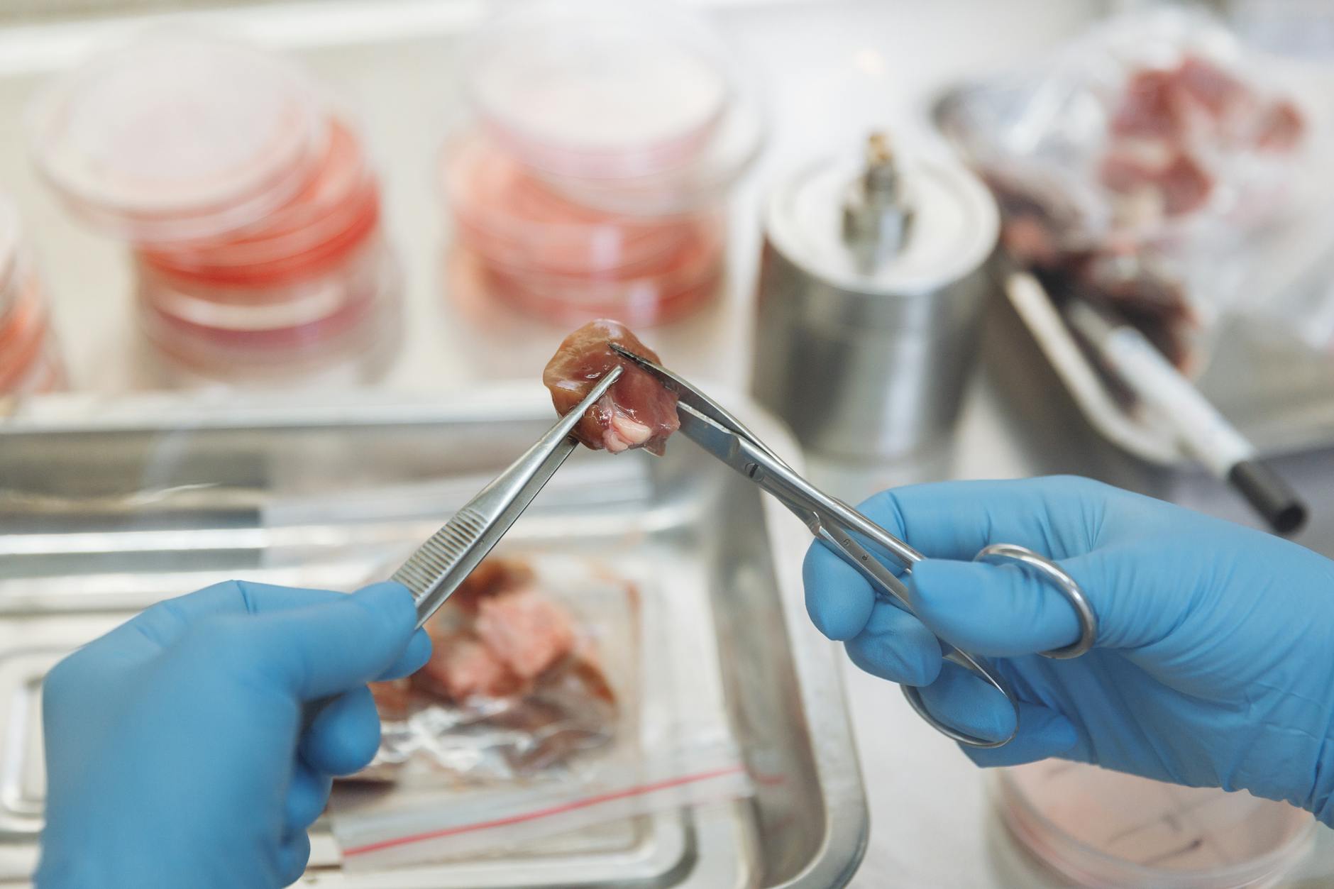 The Scientific Connection: From Plate to Colon